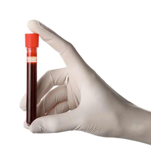 Mão do médico segurando tubo de teste com sangue no fundo branco — Fotografia de Stock
