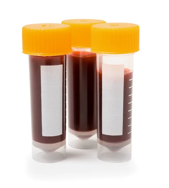 Tubos de ensaio com sangue sobre fundo branco — Fotografia de Stock