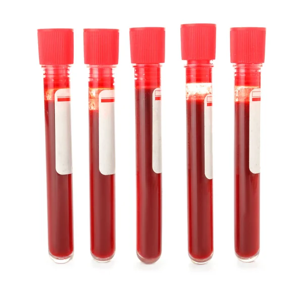 Test tubes with blood on white background — Stock Photo, Image