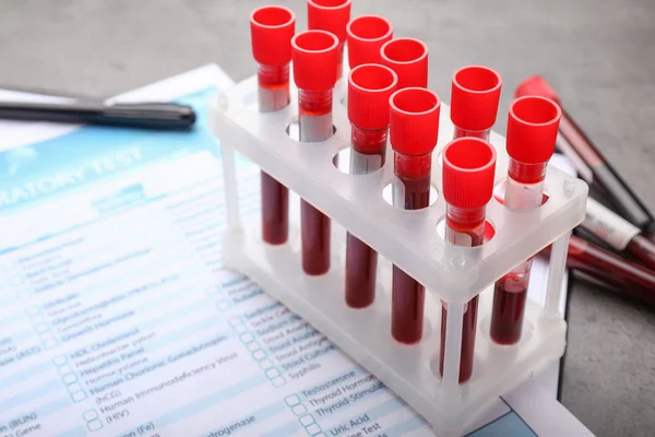 Laboratuvar test formu ve kan örnekleri masanın üzerinde. — Stok fotoğraf