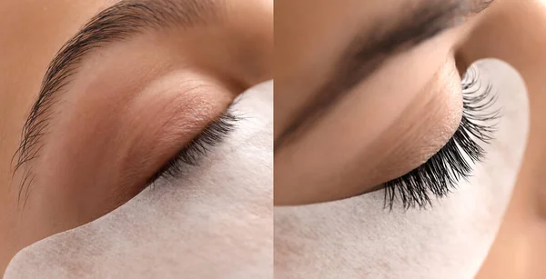 Young woman before and after eyelash extension procedure in beauty salon, closeup — Stock Photo, Image