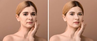 Kadın portresi renk arkaplanındaki doldurucu enjeksiyonundan önce ve sonra