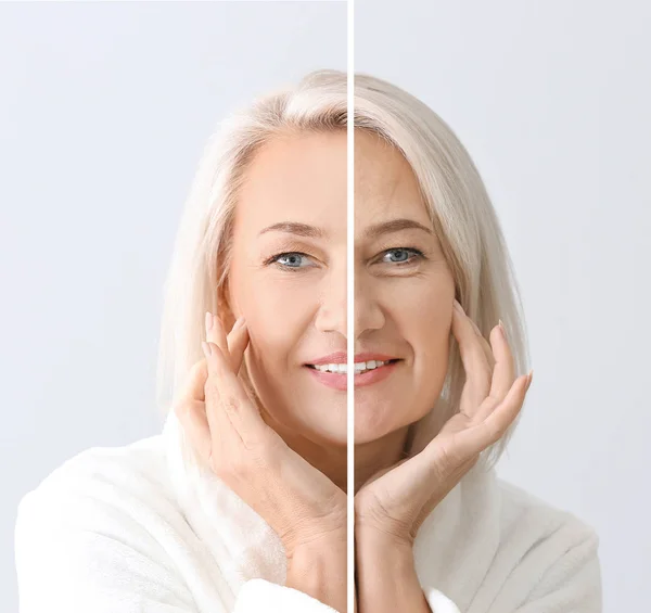 Retrato de comparación de la mujer madura después y antes de la inyección de relleno sobre fondo claro —  Fotos de Stock