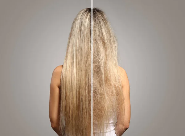 Mulher antes e depois do tratamento do cabelo no fundo cinza, visão traseira — Fotografia de Stock