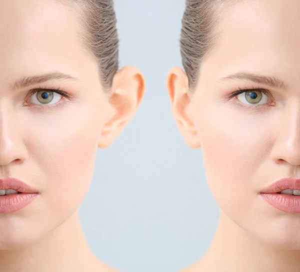 Mujer joven antes y después de la operación de plástico sobre fondo claro, primer plano —  Fotos de Stock