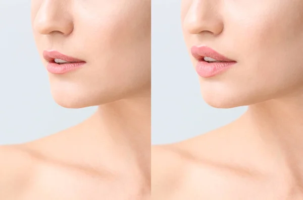 Young woman before and after plastic operation on light background, closeup — 스톡 사진