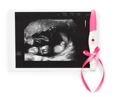 Beyaz arkaplanda hamilelik testi ve sonogram görüntüsü
