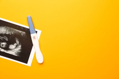 Renk arkaplanındaki hamilelik testi ve sonogram görüntüsü