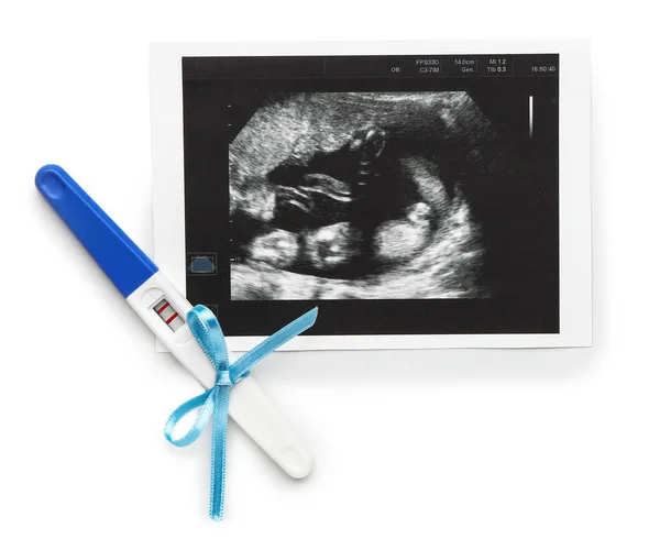 Pregnancy test and sonogram image on white background — Stock Photo, Image