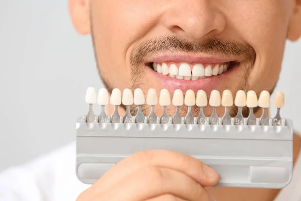 Man with teeth color samples on light background, closeup — Stock Photo, Image