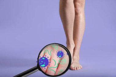 View at skin of young woman with fungal infection of feet through magnifier clipart