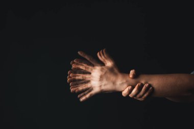 Arka planda Parkinson sendromu olan bir kadının elleri.