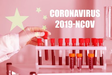 Doktor laboratuarda numuneyle çalışıyor. Coronavirüs salgını kavramı