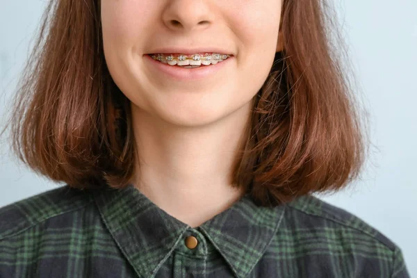 Tonårstjej med tandställning på ljus bakgrund, närbild — Stockfoto
