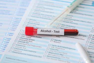 Klinikteki masada kan örneği olan sarhoş insan test tüpü.