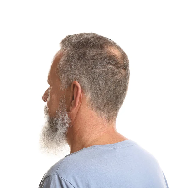 Starší muž s problémem vypadávání vlasů na bílém pozadí — Stock fotografie