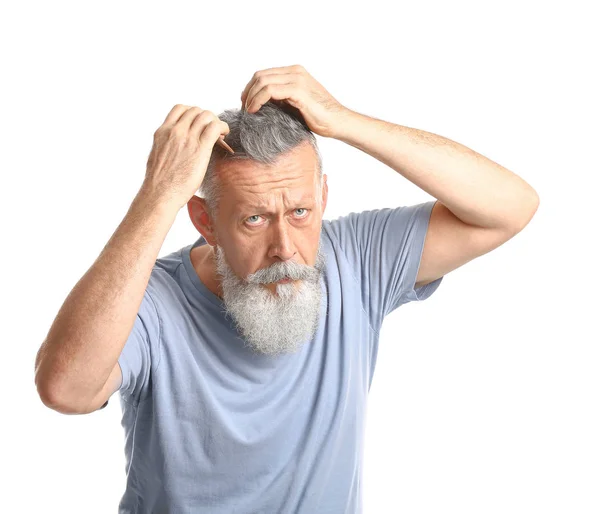 Senior man with hair loss problem on white background — Stock Photo, Image