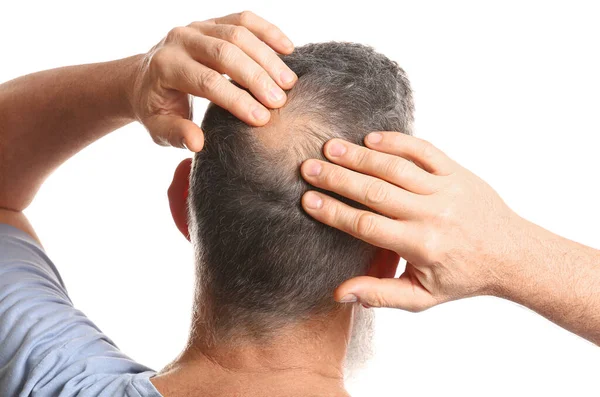 Senior man with hair loss problem on white background — Stock Photo, Image