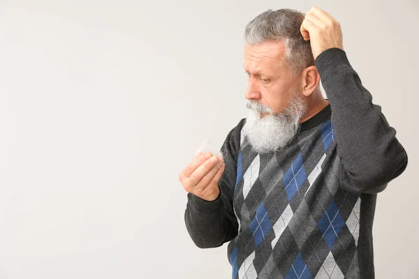 Старший Мужчина Проблемой Выпадения Волос Светлом Фоне — стоковое фото