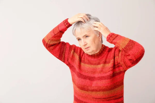 Senior Woman Hair Loss Problem Light Background — Stock Photo, Image