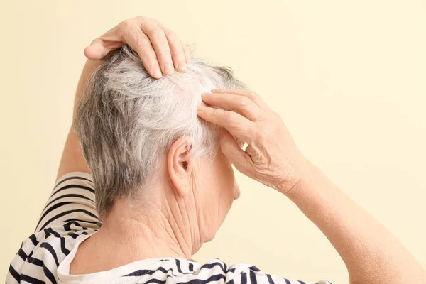 Senior Woman Hair Loss Problem Color Background — Stock Photo, Image