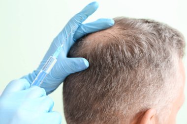 Saç dökülme sorunu olan son sınıf öğrencisi renk geçmişinde enjeksiyon yaptırıyor.