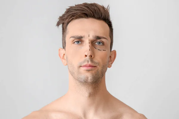 Young Man Marks His Face Light Background Concept Plastic Surgery — Stock Photo, Image