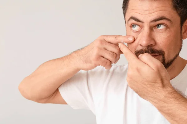 Man Sätta Kontaktlinser Ögonen Ljus Bakgrund — Stockfoto