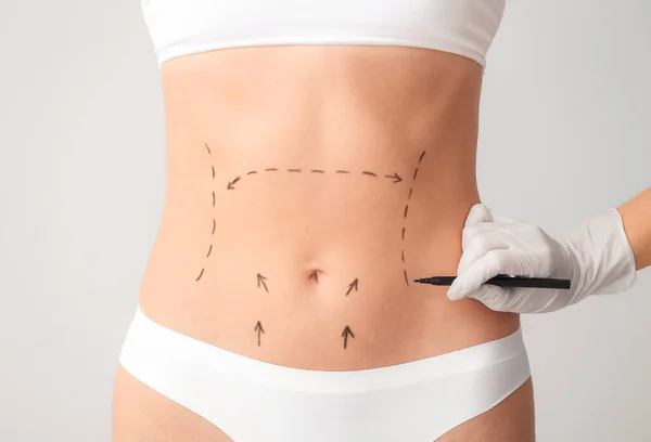 薄い背景に女性の体にマークを適用する形成外科医 — ストック写真