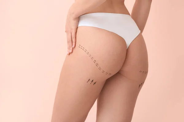 背景色を背景に腰にマークを持つ若い女性 整形手術の概念 — ストック写真