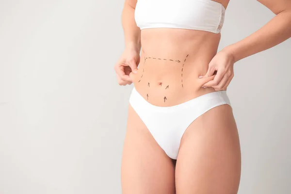 Young Woman Marks Her Belly Light Background Concept Plastic Surgery — Stock Photo, Image