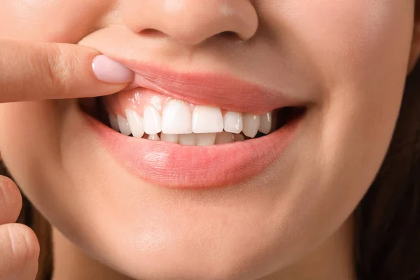 Sağlıklı Diş Etleri Olan Genç Bir Kadın Yakın Plan — Stok fotoğraf