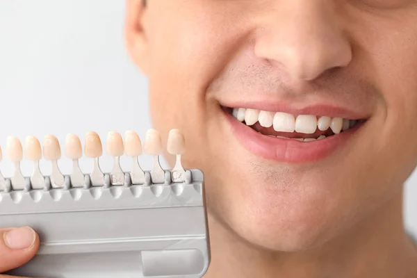 Man Med Tänder Färg Prover Ljus Bakgrund Närbild — Stockfoto