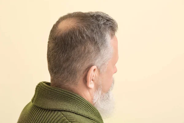Старший Мужчина Проблемой Потери Волос Цветном Фоне — стоковое фото