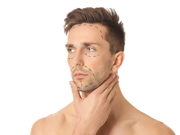 Young Man Marks His Face White Background Concept Plastic Surgery — Stock Photo, Image