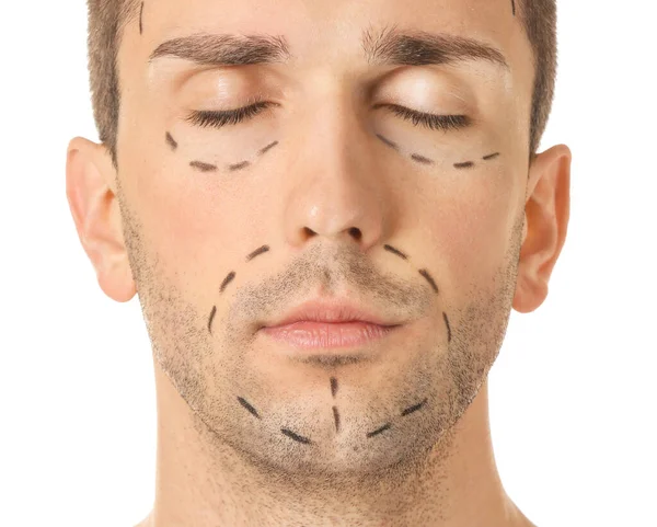 Young Man Marks His Face White Background Closeup Concept Plastic — Stock Photo, Image