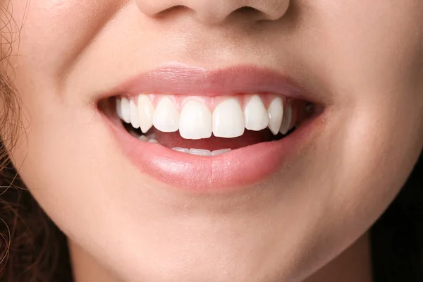 Wanita Bahagia Dengan Gigi Yang Sehat Closeup — Stok Foto