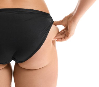 Beyaz arka planda selülit sorunu olan genç bir kadın, yakın plan.