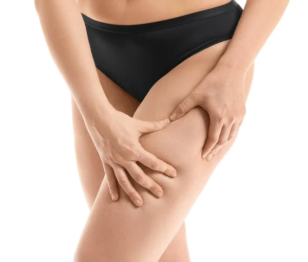 Young Woman Cellulite Problem White Background — Stock Photo, Image