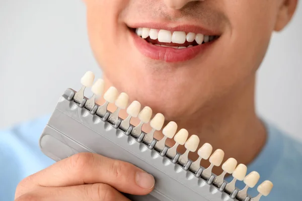 Muž Barevnými Zuby Vzorky Světlém Pozadí Detailní Záběr — Stock fotografie