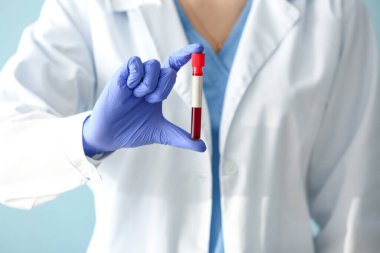 Doktor elinde kan örneğiyle test tüpü tutuyor, yakın plan.