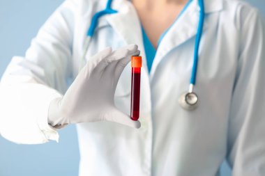 Doktor elinde kan örneğiyle test tüpü tutuyor, yakın plan.
