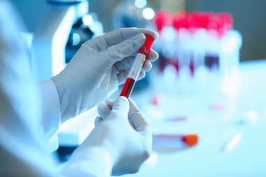 Doktor laboratuvarda kan örnekleriyle çalışıyor.