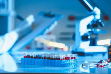 Kan örnekleri laboratuvar tablo ile test tüpleri