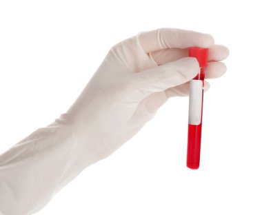 Doktorun eli, beyaz arka planda kan örneği olan test tüpünü tutuyor.
