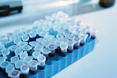 Kan örnekleri laboratuvar tablo ile test tüpleri