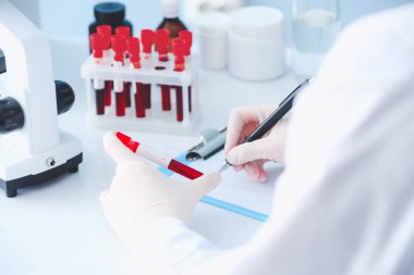 Doktor laboratuvarda kan örnekleriyle çalışıyor.
