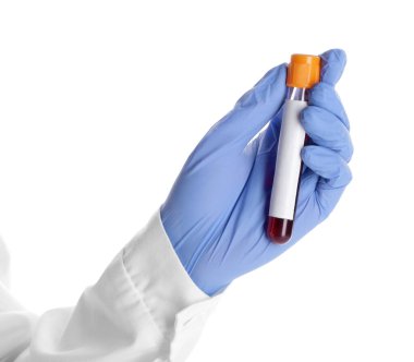 Doktorun eli, beyaz arka planda kan örneği olan test tüpünü tutuyor.