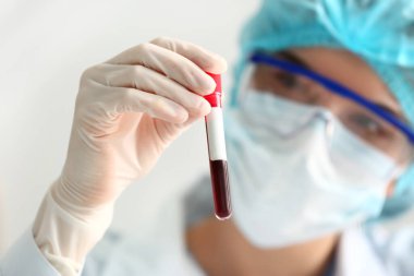Doktor laboratuvarda kan örnekleriyle çalışıyor.