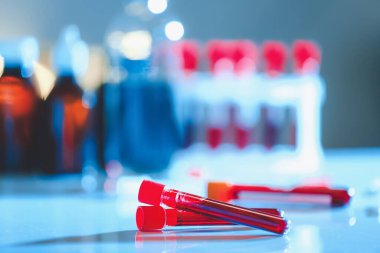 Kan örnekleri laboratuvar tablo ile test tüpleri